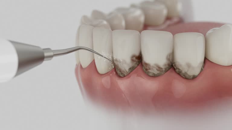 Trusted Root Canal Treatment service in Glenmoor, OH - Dentist Open Now